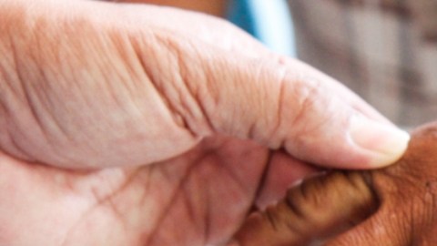 Aumentan casos de lepra en Florida: advierten los CDC