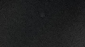 La lesión de Trevon Diggs fue confirmada por una resonancia.