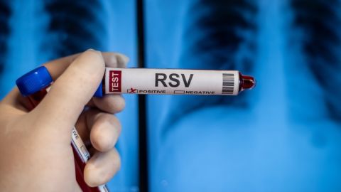 CDC advierten un repunte de casos de virus respiratorio en niños de EE.UU.: cómo prevenirlo