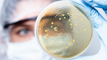 Bacterias carnívoras: qué son y por qué los CDC están advirtiendo a doctores en EE.UU.