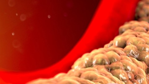 Un fármaco virtual ayudará a mejorar la resolución de imágenes cardíacas