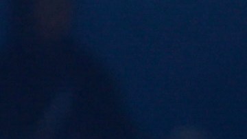 Borisa Simanic (derecha) fue el jugador que perdió el riñón en la operación.