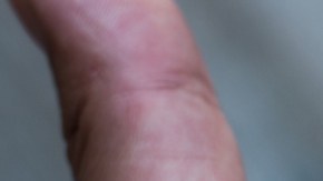 Los casos de sarampión en una provincia de El Congo superan los 1,000 en lo que va de año