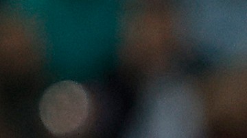 Diego Reyes fue operado de su brazo derecho.