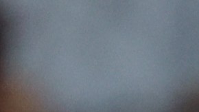 Diego Valdés salió del encuentro en el minuto 22 de acción.