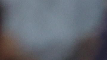 Diego Valdés salió del encuentro en el minuto 22 de acción.