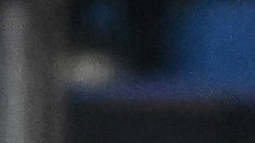 Neymar Jr. sufrió una rotura del ligamento cruzado anterior y de menisco en la rodilla izquierda.