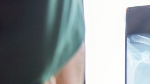 Alertan sobre caso de tuberculosis activa en estudiante de Kansas