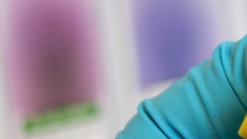 Mujeres y hombres con VIH experimentan diferentes formas de estigma: estudio