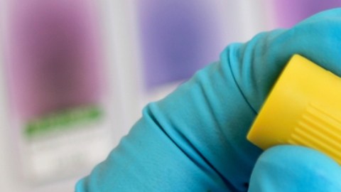 Mujeres y hombres con VIH experimentan diferentes formas de estigma: estudio