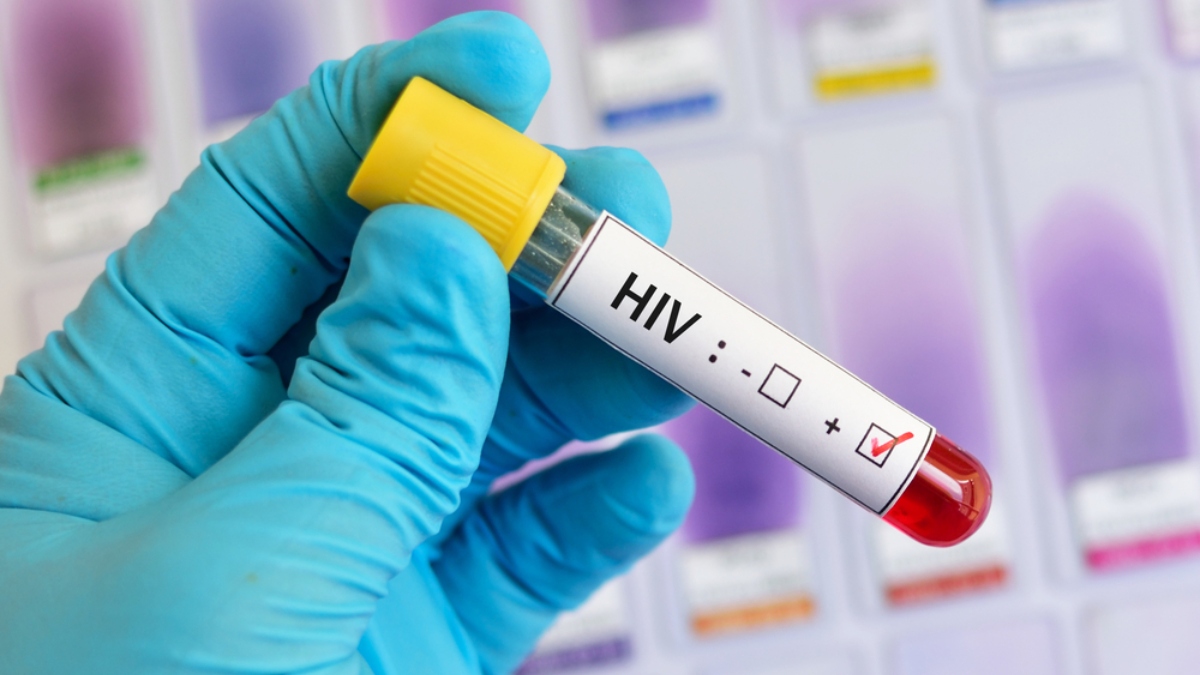 HIV陽性者も臓器移植を受けられるようになる