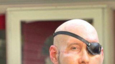 Eduardo Rodríguez (derecha) fue uno de los cirujanos que dirigió el trasplante de Aaron James (izquierda).