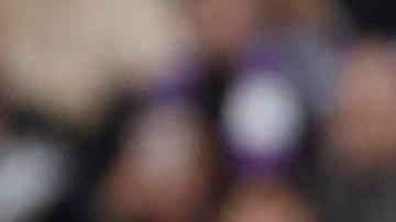 Bellingham sufrió una lesión en su hombro a mitad de partido.