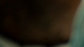 Muere segunda persona en recibir trasplante de corazón de cerdo seis semanas después de la cirugía