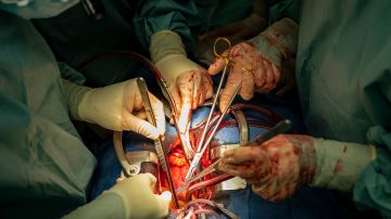 Muere segunda persona en recibir trasplante de corazón de cerdo seis semanas después de la cirugía