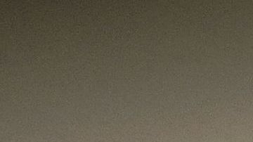 El primer paciente del mundo con trasplante de ojo completo se adapta a una nueva normalidad