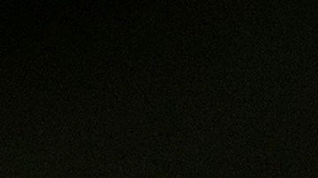 "Querían matarme": Hombre de California fue mordido por nutrias agresivas