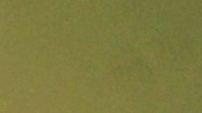 Enigma médico: hallan mosca intacta en el colon de un hombre