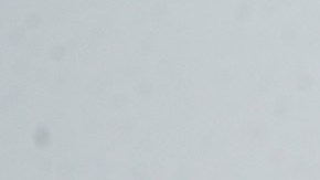 Niebla espesa causó una colisión de 30 vehículos en una interestatal de Idaho