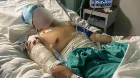 Los hermanos se encuentran hospitalizados en Oaxaca.