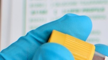 Terapia génica: qué es y cómo ayuda a bajar el colesterol