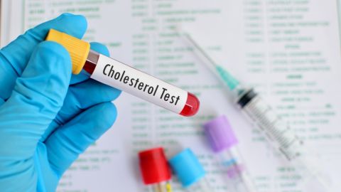 Terapia génica: qué es y cómo ayuda a bajar el colesterol