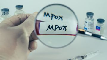 ONU confirma propagación de mpox en El Congo: qué debemos saber