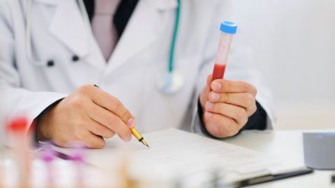 Un análisis de sangre podría ayudar en el diagnóstico de párkinson