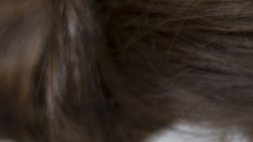 Casos de sarampión aumentan en todo el mundo: OMS