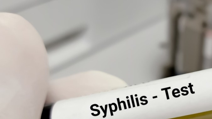 Sífilis ocular: aumenta la preocupación por 5 casos de esta enfermedad en EE.UU.