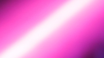 Kelly Osbourne quiere una cirugía plástica para Navidad, pero su familia lo desaprueba