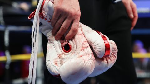 Guantes de boxeo, foto referencial.