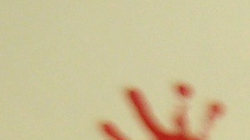 CDC calculan 200 casos de envenenamiento por plomo en 33 estados tras comer puré de manzana