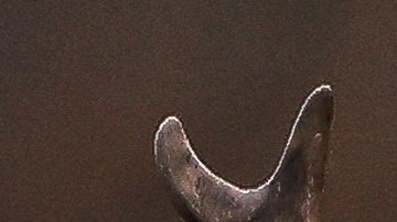 Venado ataca a mujer de 67 años en Colorado y le perfora la pierna