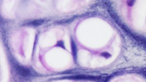 Científicos crean pequeños robots de células humanas que son capaces de regenerar tejidos