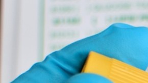 Tener el colesterol bueno muy alto puede ser malo para tu memoria: por qué