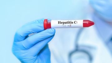 CDC recomiendan pruebas de hepatitis C a bebés expuestos