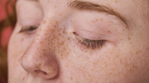 Esto es lo que quiere decir la piel de las personas con pecas
