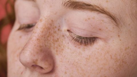Esto es lo que quiere decir la piel de las personas con pecas