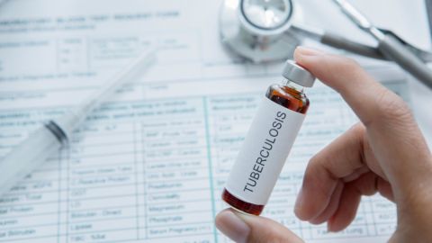 Alerta de tuberculosis en 12 escuelas de Las Vegas