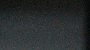 A view of the hand of one of three HIV-infected patients of the specialized Lavra hospital in Kiev who remain handcuffed to the steel frame of a bed as they start an unlimited protest against a government decision to force the closing and relocation of the HIV patients care unit, on September 12, 2013. The three patients and some employees of the unique Ukrainian hospital unit are protesting the Ukrainian government's decision to close the unit and relocate it outside of the city center saying the new location does not fit the standards for proper treatment. Ukraine has one of the fastest growing HIV/AIDS epidemics in the world. AFP PHOTO/ SERGEI SUPINSKY (Photo credit should read SERGEI SUPINSKY/AFP via Getty Images)