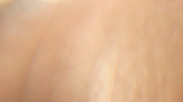 Brote de sarampión en Filadelfia enciende alerta en hospitales por niño que rompió cuarentena y fue a guardería