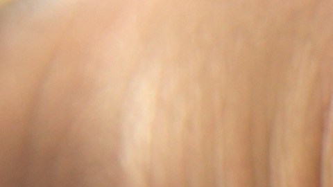 Brote de sarampión en Filadelfia enciende alerta en hospitales por niño que rompió cuarentena y fue a guardería