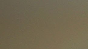 Mujer en Nevada presenta demanda contra médico que le dejó esponja quirúrgica dentro tras cesárea hace 18 años