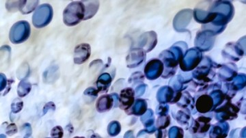 CDC declaran epidemia de sífilis en Estados Unidos