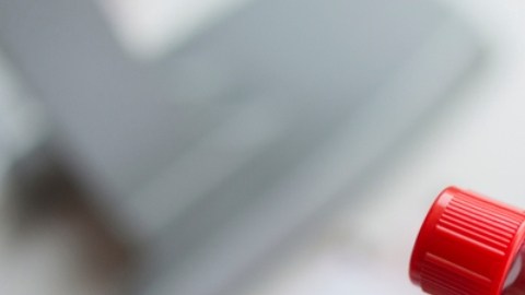 Mujeres trans están en riesgo de contraer VIH debido a la discriminación: CDC