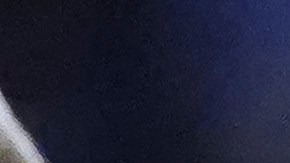 El uruguayo Gabriel Fernández justo en el momento de ser atendido de la grave lesión en la rodilla durante el duelo contra Atlético San Luis. Foto: Rafael Vadillo