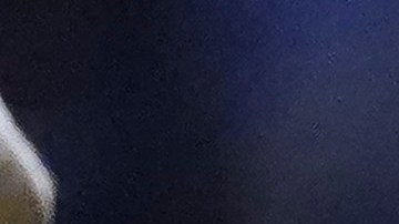 El uruguayo Gabriel Fernández justo en el momento de ser atendido de la grave lesión en la rodilla durante el duelo contra Atlético San Luis. Foto: Rafael Vadillo