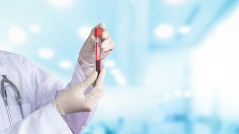 Cómo un análisis de sangre puede predecir riesgos de psicosis