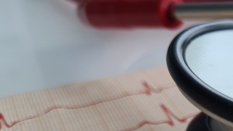 Cómo un marcapasos cerebral podría ayudar a mejorar los síntomas depresivos